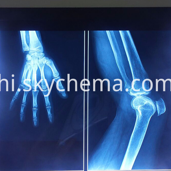 मेडिकल फिल्म 6-3 medical film 6-3